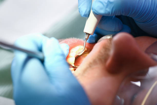 Best Emergency Dental Surgery in Mount Vernon, VA